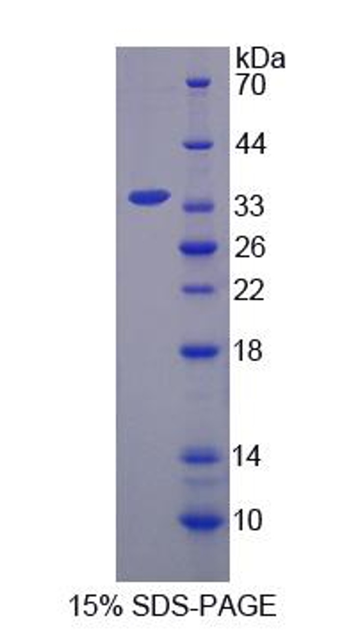 Mouse Recombinant NADH Dehydrogenase, Quinone 1 (NQO1)