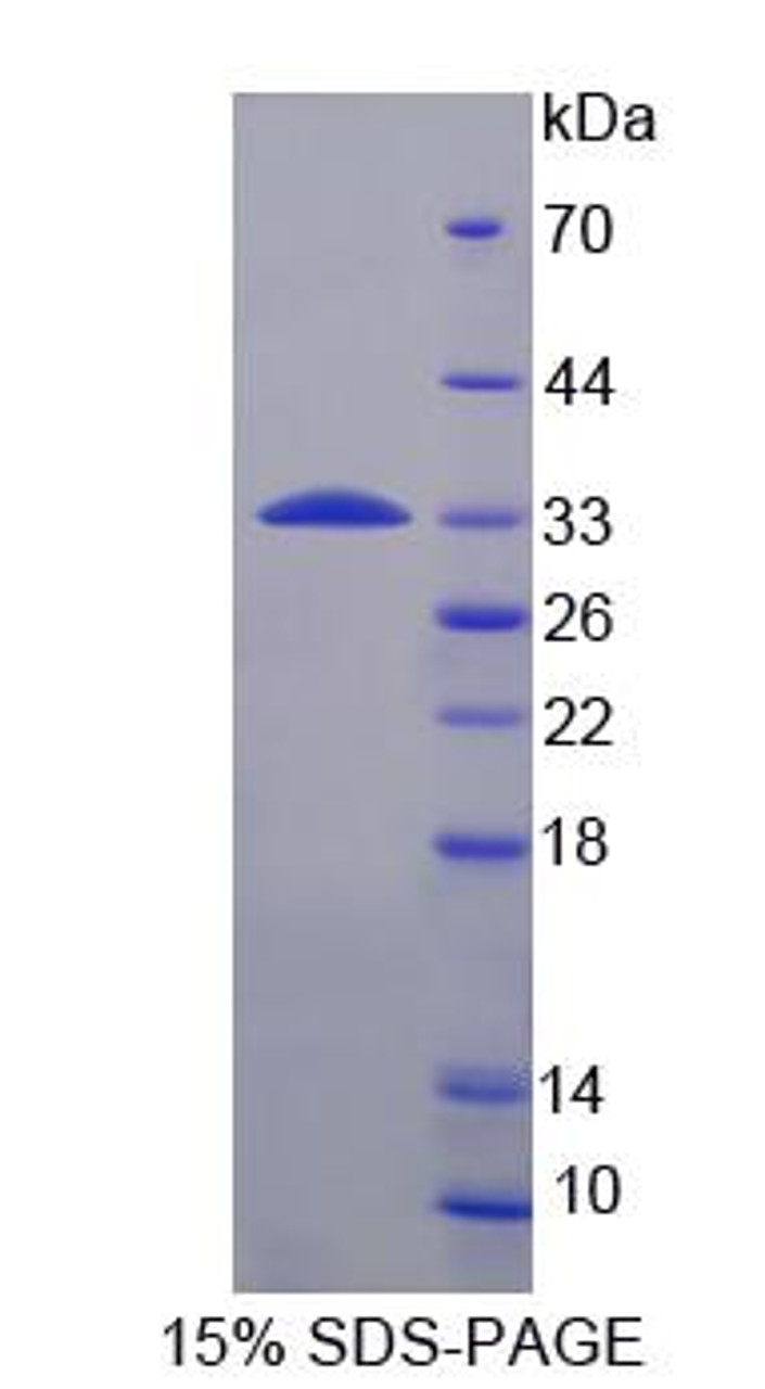 Human Recombinant Ribosomal Protein S6 Kinase Beta 1 (RPS6Kb1)