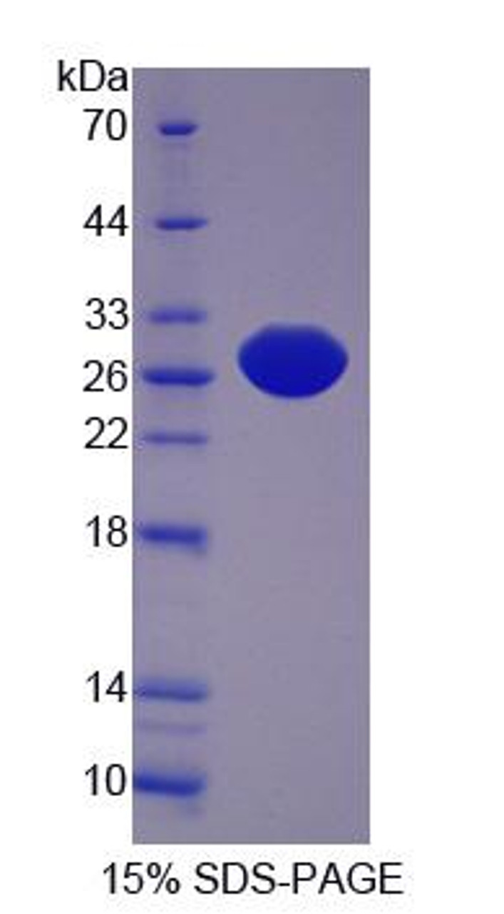 Human Recombinant Protein L-Isoaspartate-O-Methyltransferase (PCMT1)