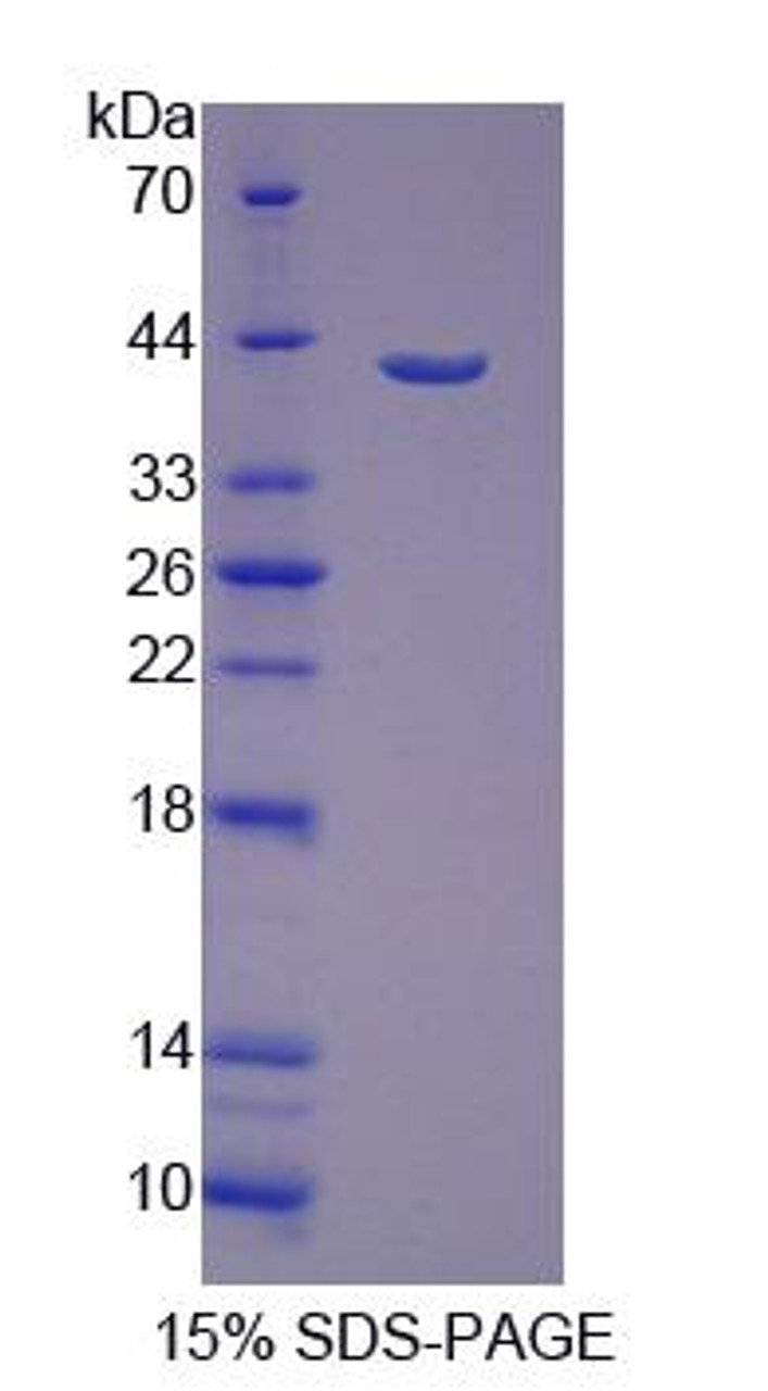 Human Recombinant PDZ And LIM Domain Protein 1 (PDLIM1)