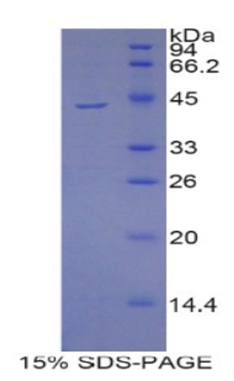 Mouse Recombinant Prolactin Induced Protein (PIP)