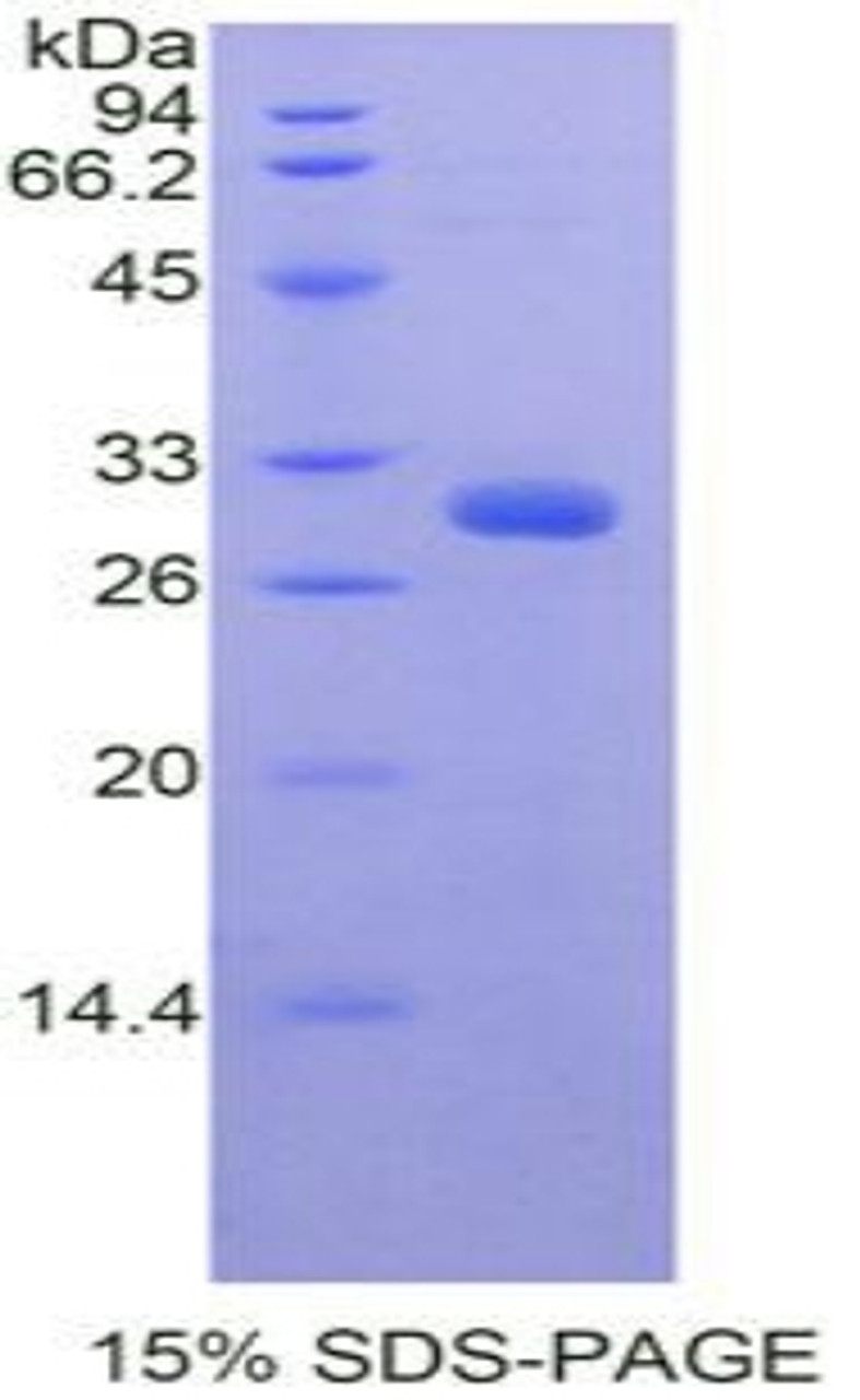 Mouse Recombinant PR Domain Containing Protein 1 (PRDM1)