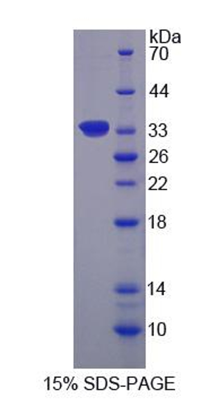 Human Recombinant Ribosomal Protein S6 Kinase Alpha 1 (RPS6Ka1)