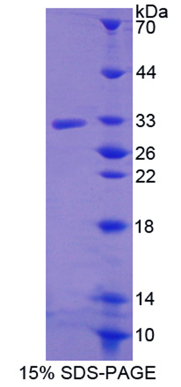 Human Recombinant R-Spondin 3 (RSPO3)