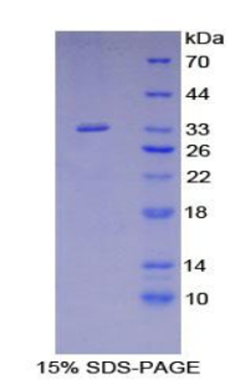 Human Recombinant Src Homology 2 Domain Containing Adapter Protein B (SHB)
