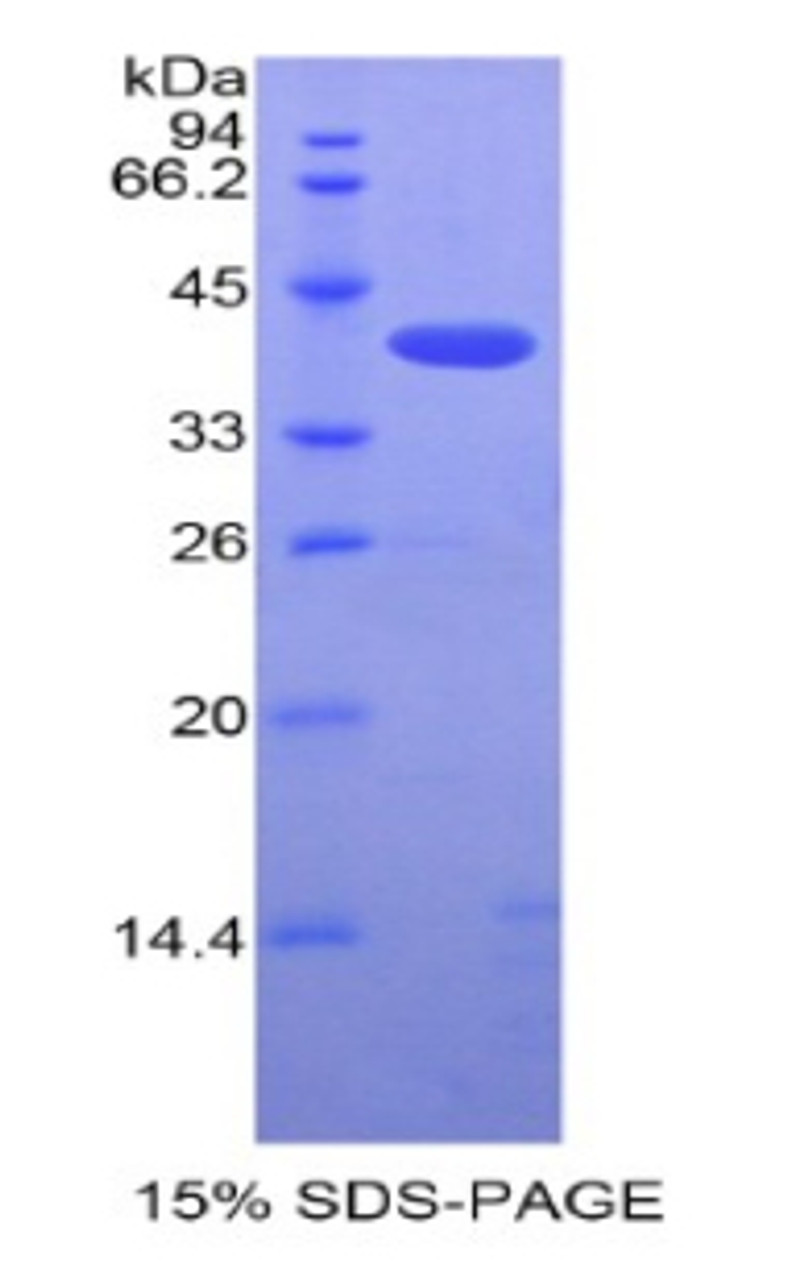 Mouse Recombinant Single Ig IL1 Related Receptor (SIGIRR)