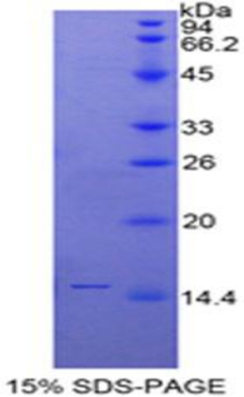 Human Recombinant Secreted Ly6/uPAR Related Protein 1 (SLURP1)