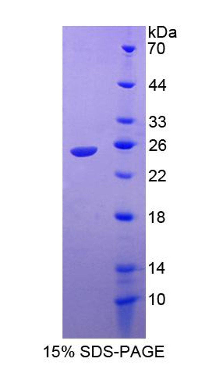 Human Recombinant Ras Related C3 Botulinum Toxin Substrate 1 (Rac1)