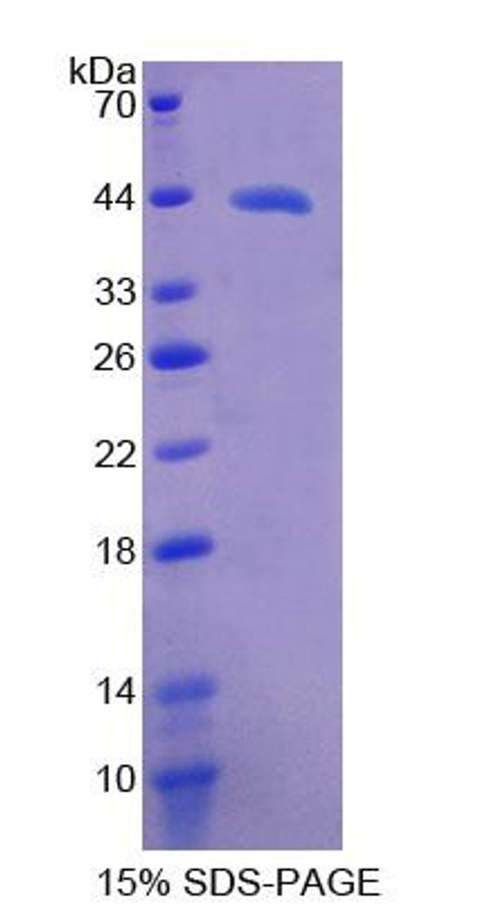 Human Recombinant Phospholipase A2, Group IVD (PLA2G4D)