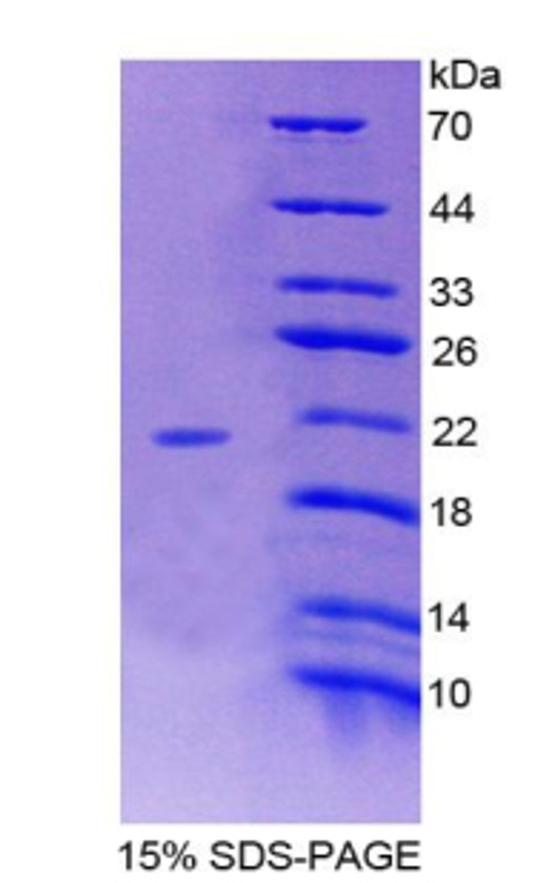 Human Recombinant POTE Ankyrin Domain Family, Member G (POTEG)