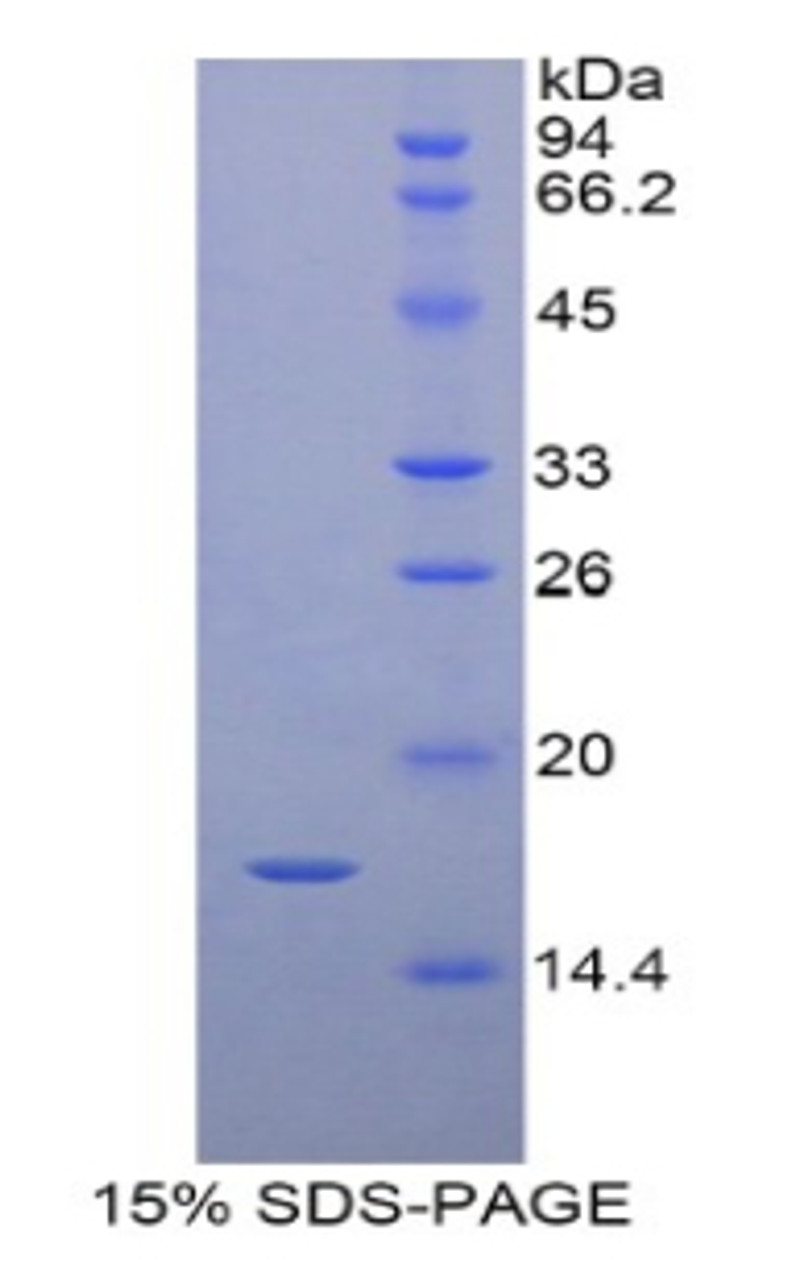 Pig Recombinant Retinol Binding Protein 7, Cellular (RBP7)