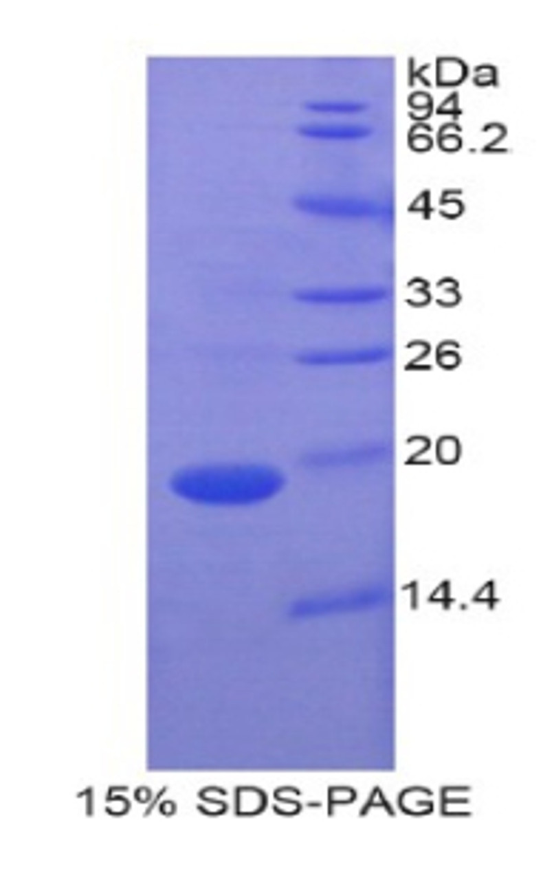 Pig Recombinant Retinol Binding Protein 7, Cellular (RBP7)