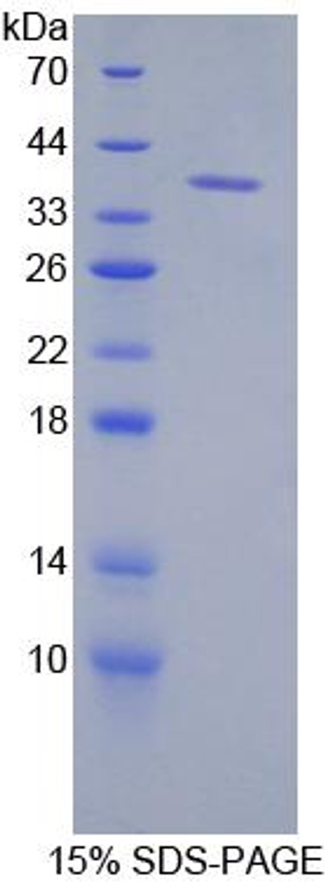 Mouse Recombinant Keratin 71 (KRT71)