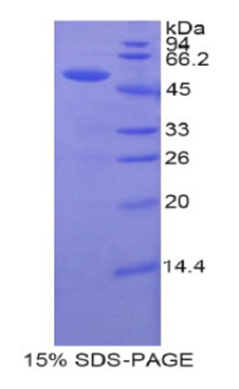 Human Recombinant Uracil Phosphoribosyltransferase (UPRT)