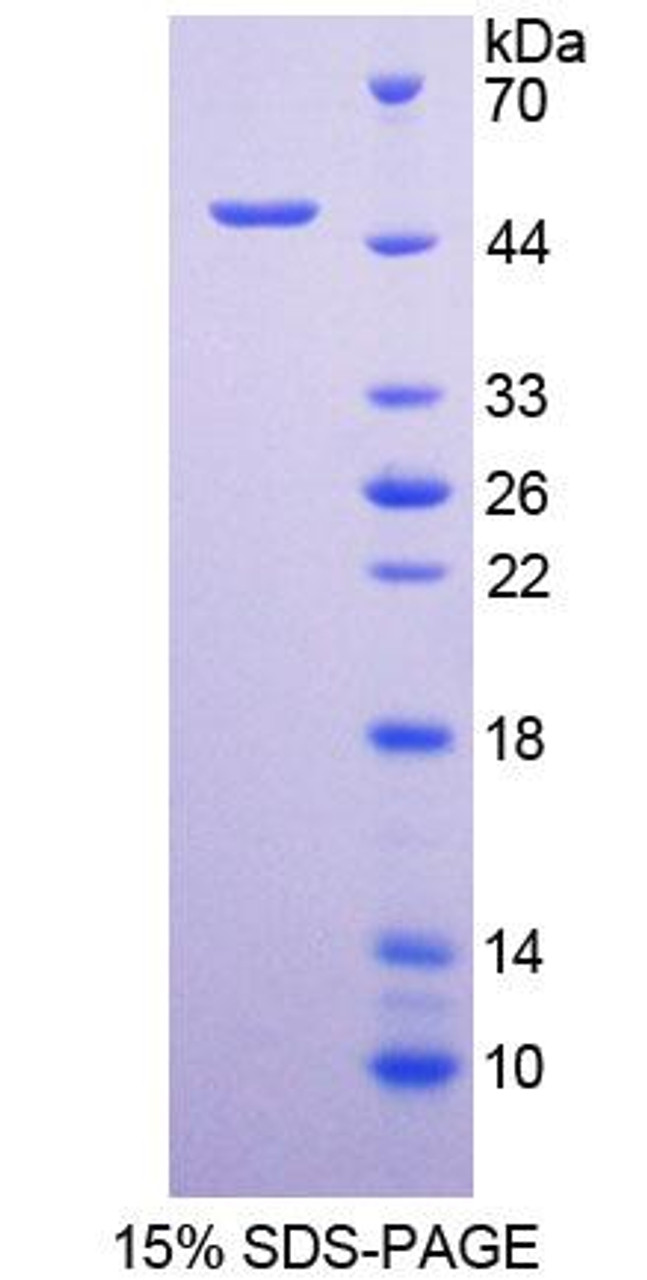 Human Recombinant Hepatocellular Carcinoma Related Protein 1 (HCRP1)
