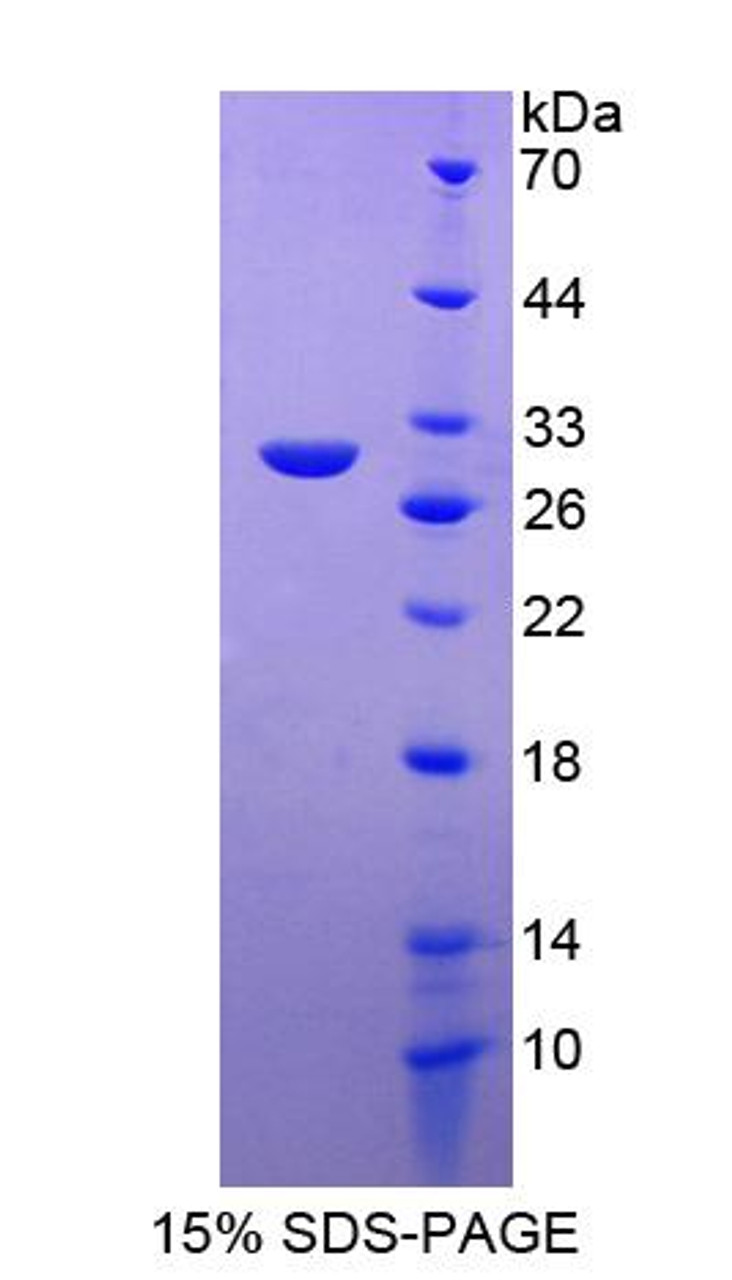 Human Recombinant Progesterone Immunomodulatory Binding Factor 1 (PIBF1)