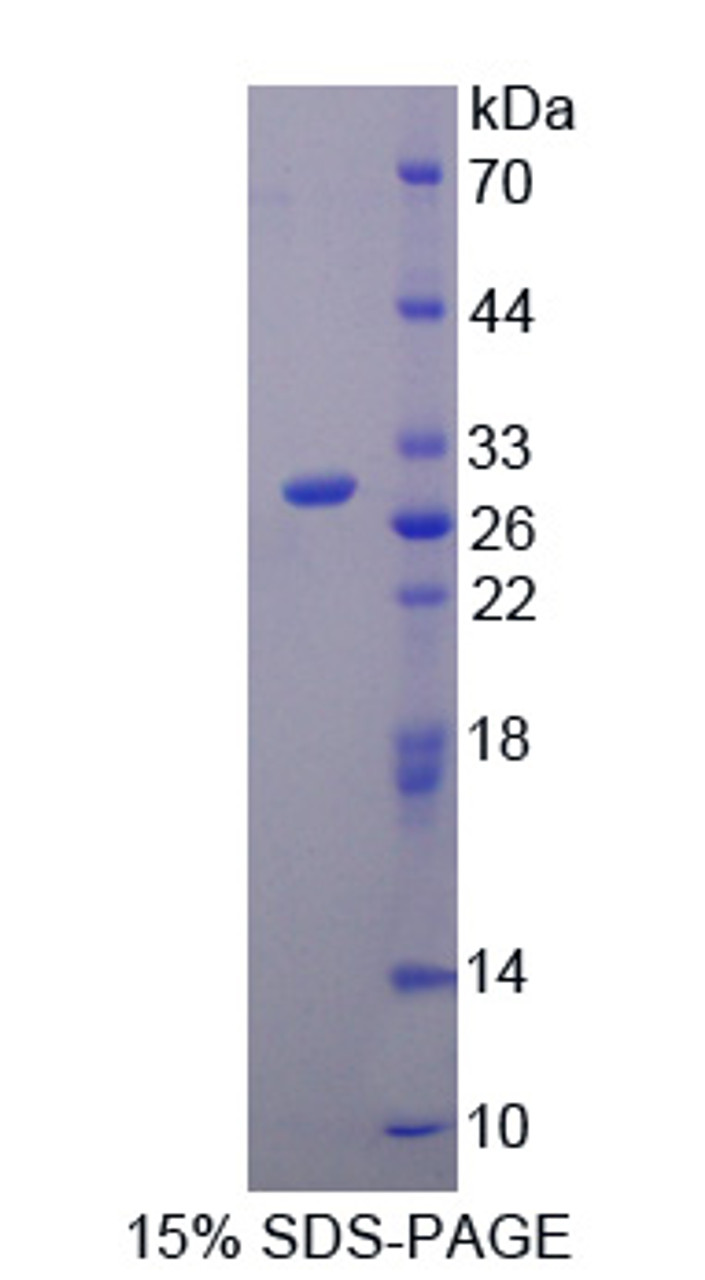 Human Recombinant Angiopoietin Like Protein 6 (ANGPTL6)