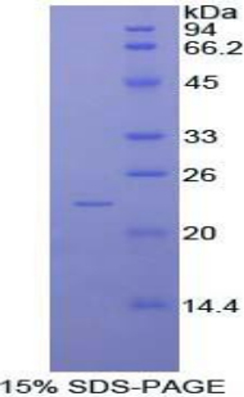 Mouse Recombinant Non Metastatic Cells 6, Protein Expressed In (NME6)