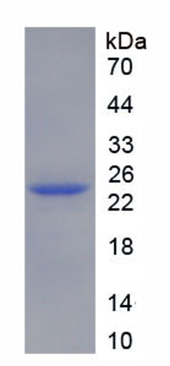 Rat Recombinant Non Metastatic Cells 6, Protein Expressed In (NME6)