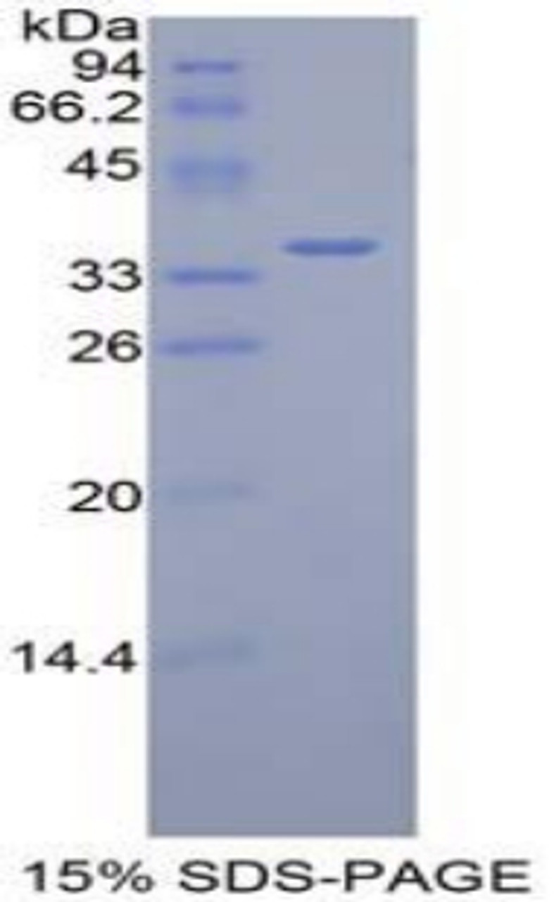 Mouse Recombinant Dispatched Homolog 1 (DISP1)