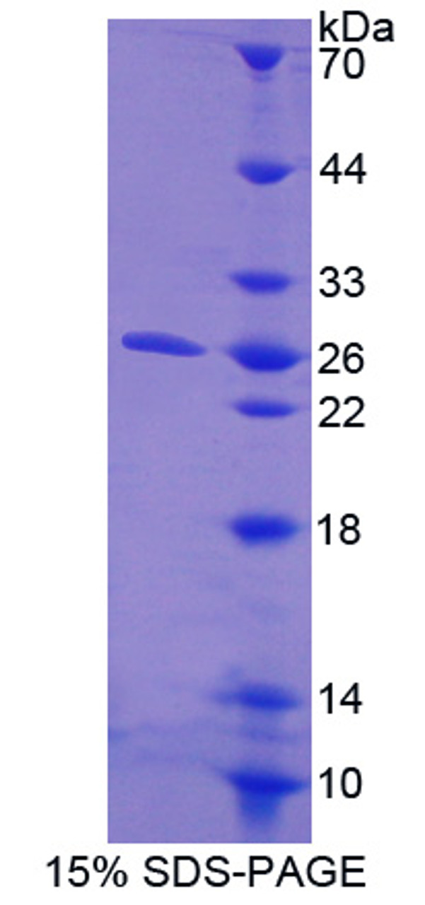 Human Recombinant Collagen Triple Helix Repeat Containing Protein 1 (CTHRC1)