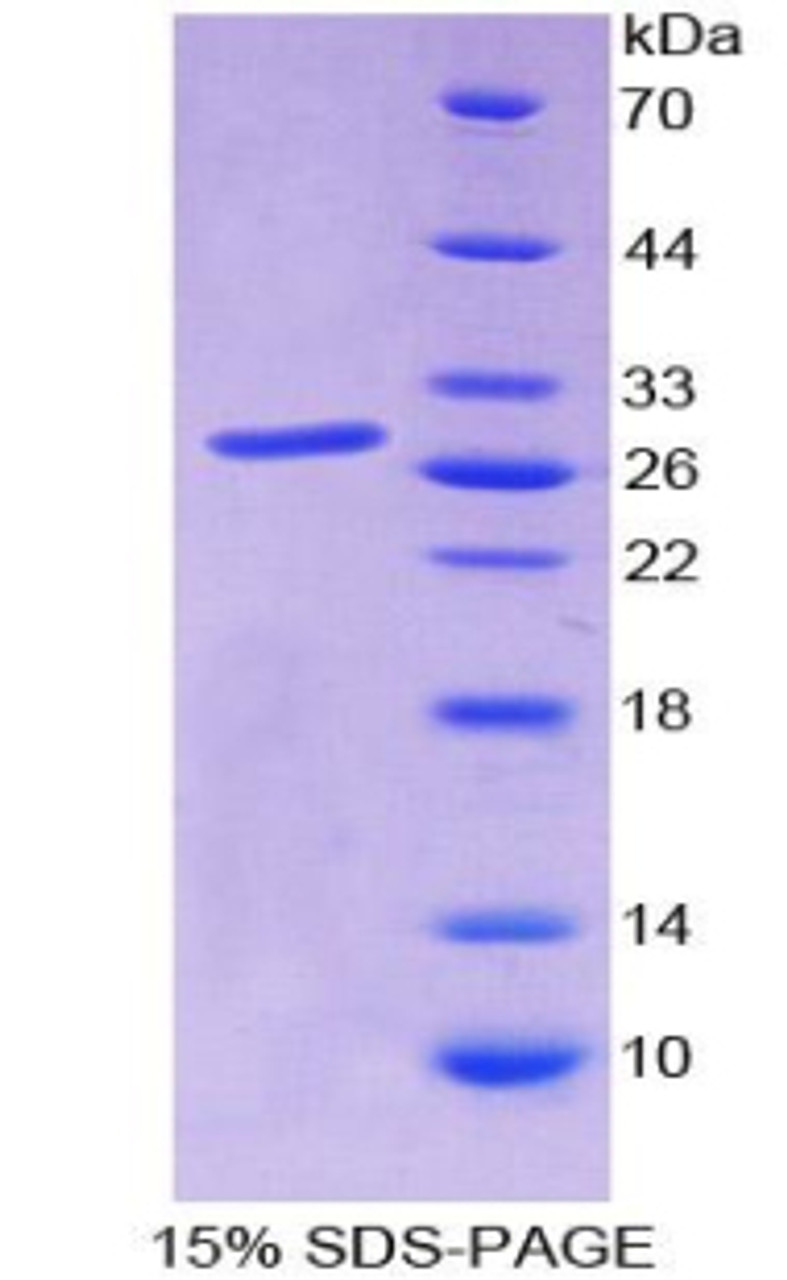 Human Recombinant Sp140 Nuclear Body Protein (SP140)