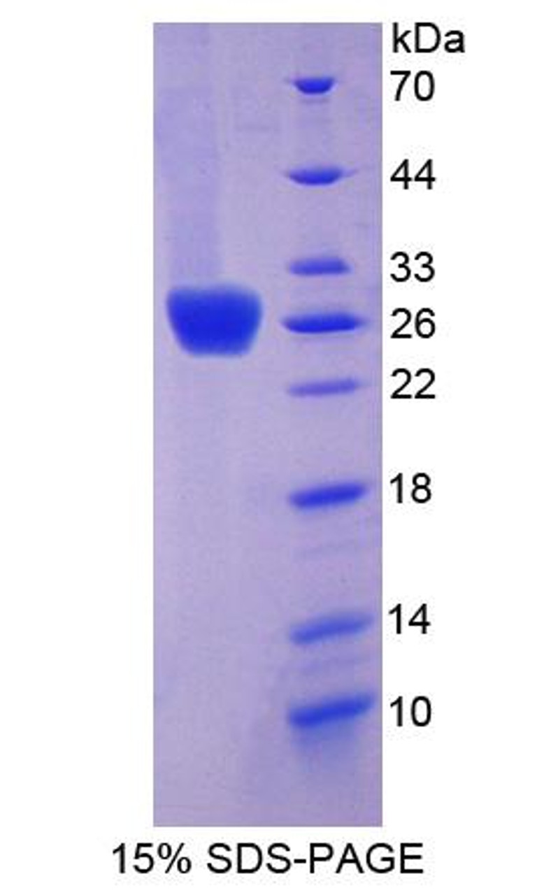 Mouse Recombinant Thrombospondin Type I Domain Containing Protein 7A (THSD7A)