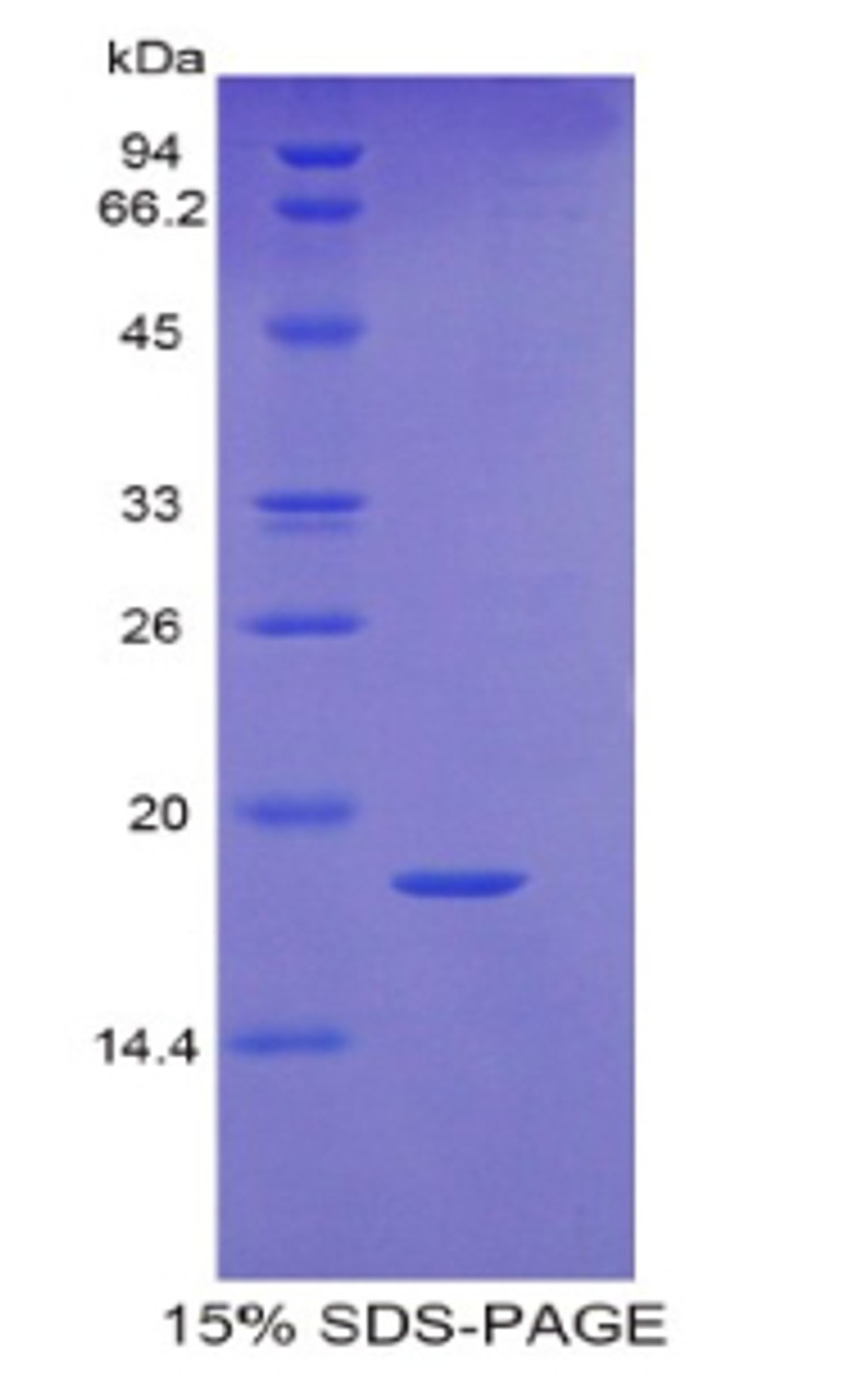 Human Recombinant Retinol Binding Protein 5, Cellular (RBP5)