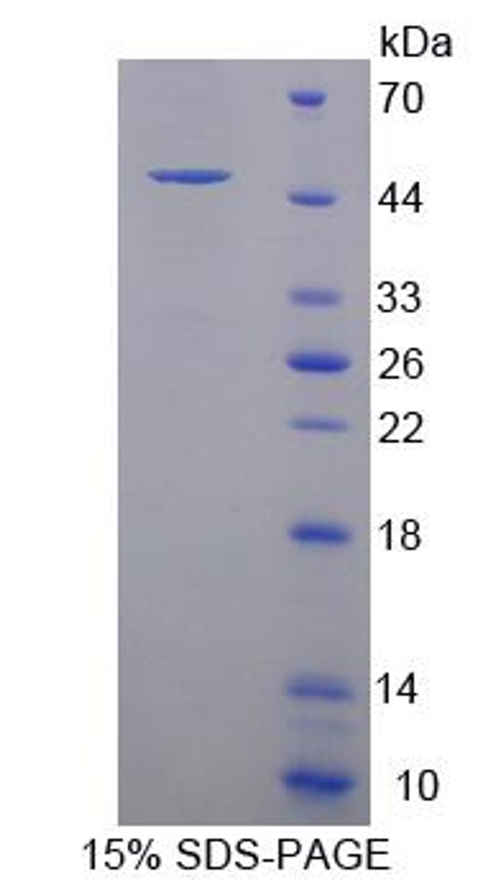 Human Recombinant PR Domain Containing Protein 14 (PRDM14)