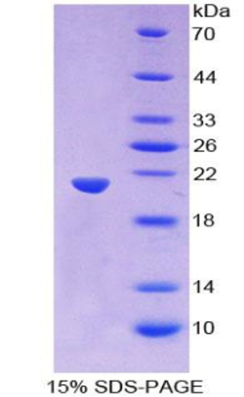Human Recombinant Wingless Type MMTV Integration Site Family, Member 11 (WNT11)