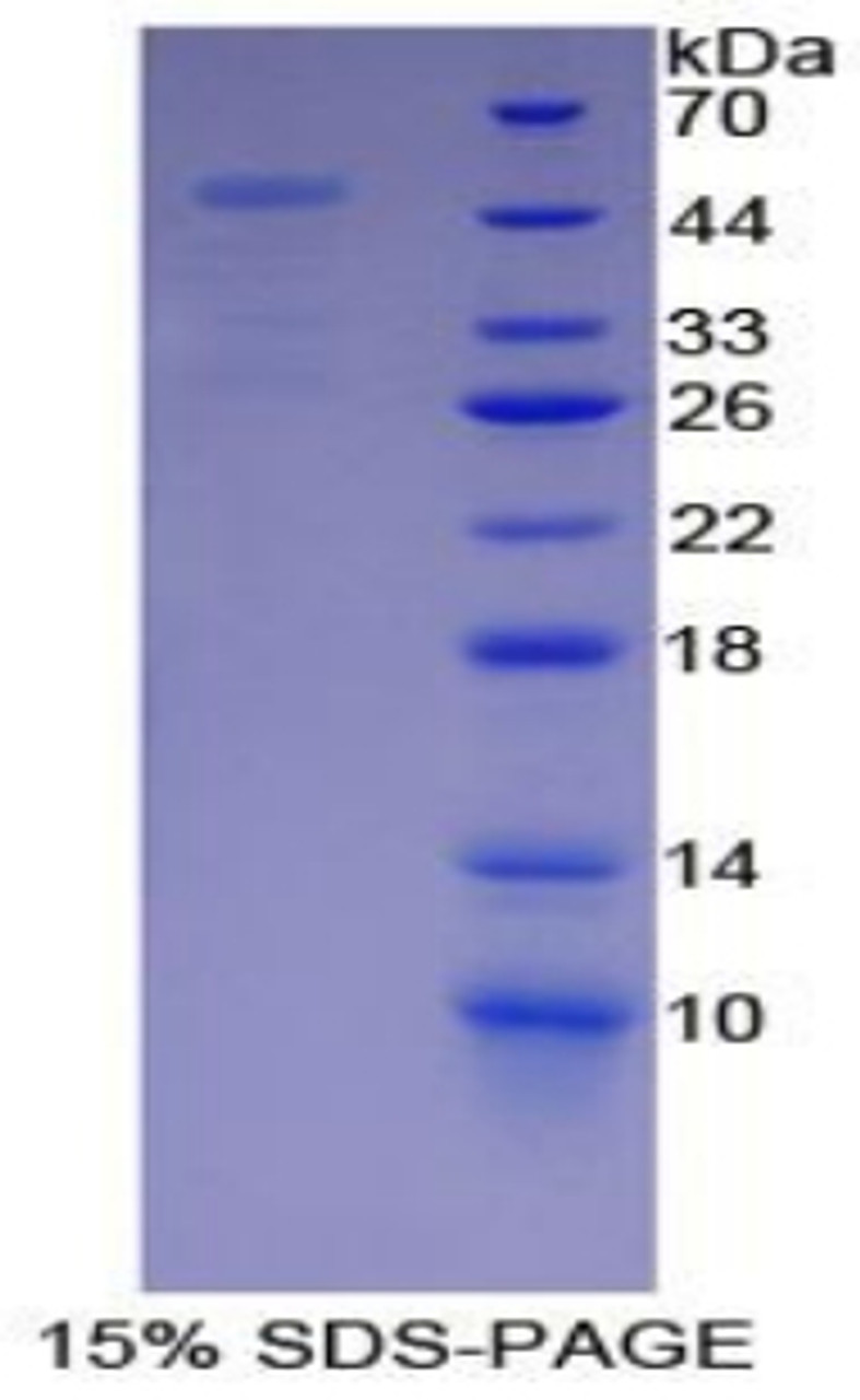 Human Recombinant Proteasome 26S Subunit, Non ATPase 13 (PSMD13)