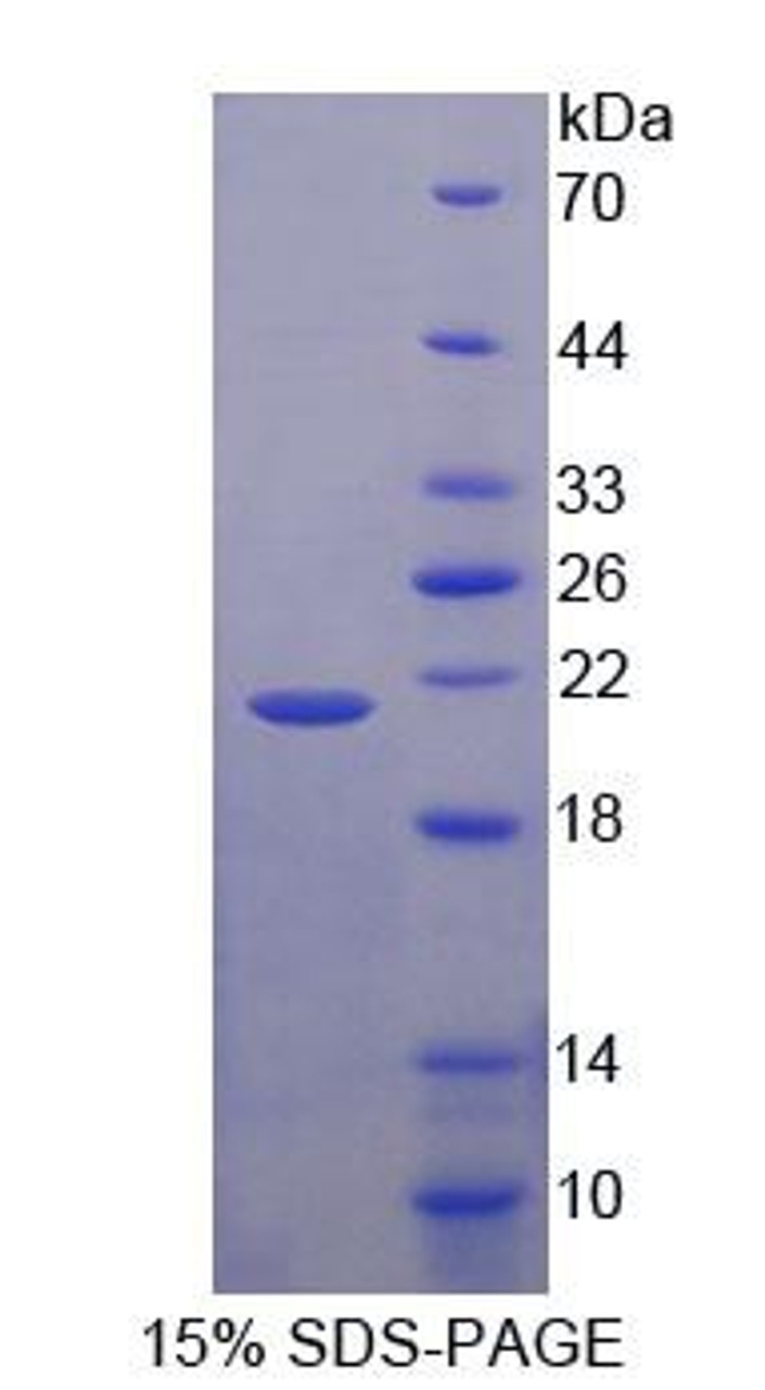 Human Recombinant Neuroblastoma, Suppression Of Tumorigenicity 1 (NBL1)