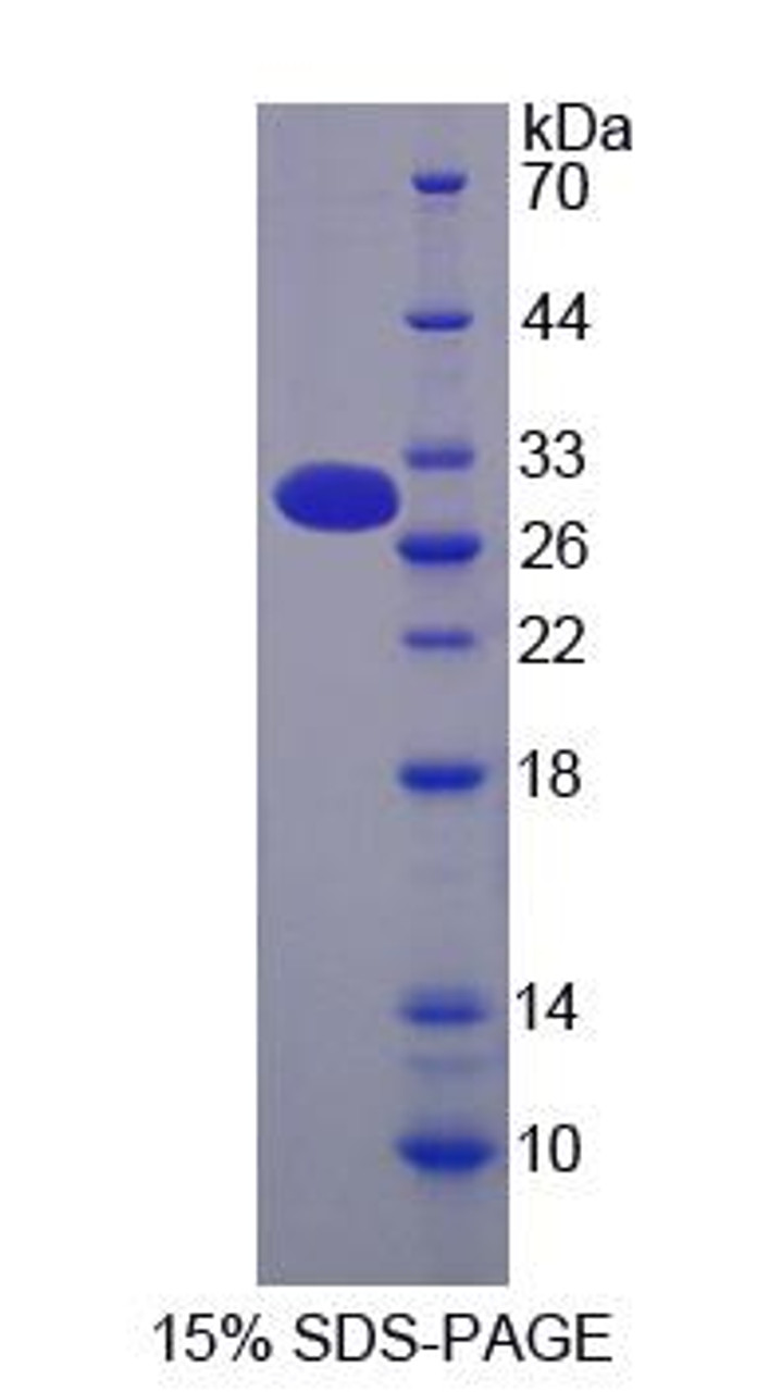 Human Recombinant Mucin 13, Cell Surface Associated (MUC13)