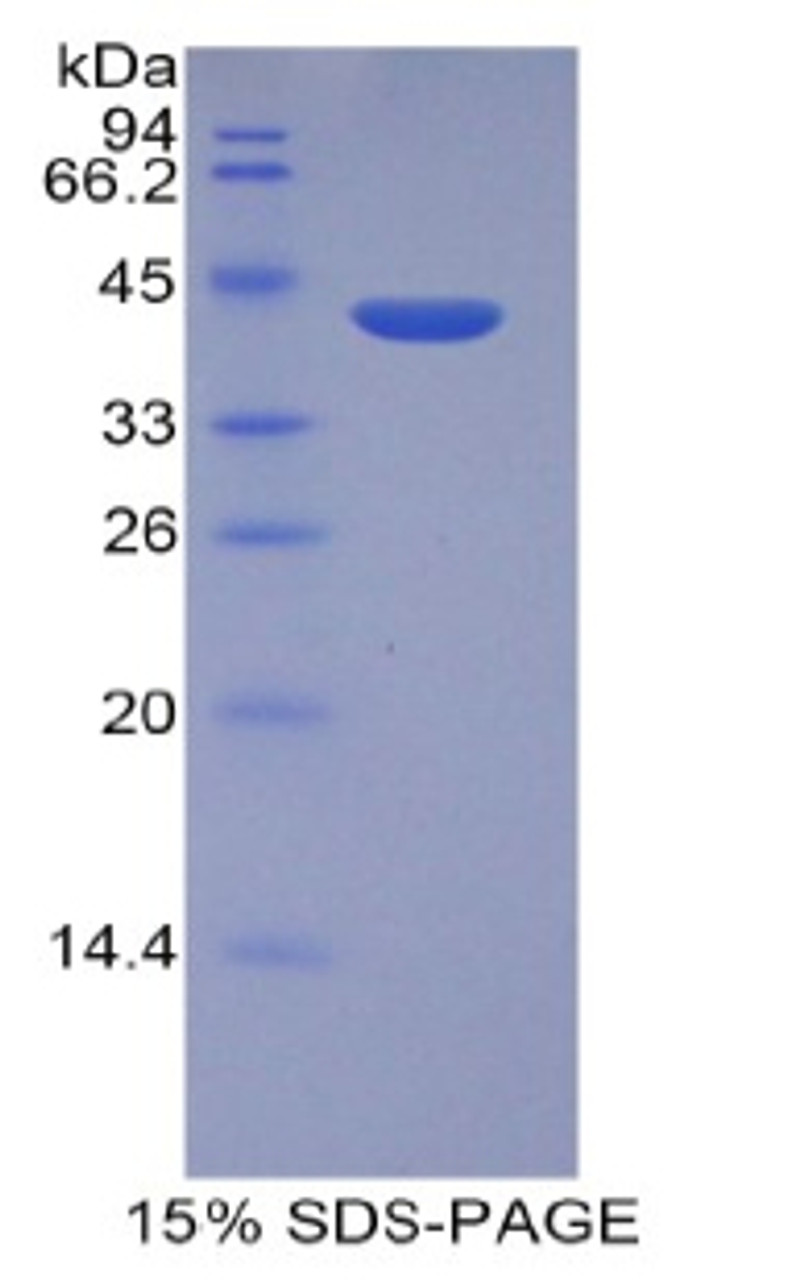 Human Recombinant Histone Cluster 2, H2aa3 (HIST2H2AA3)