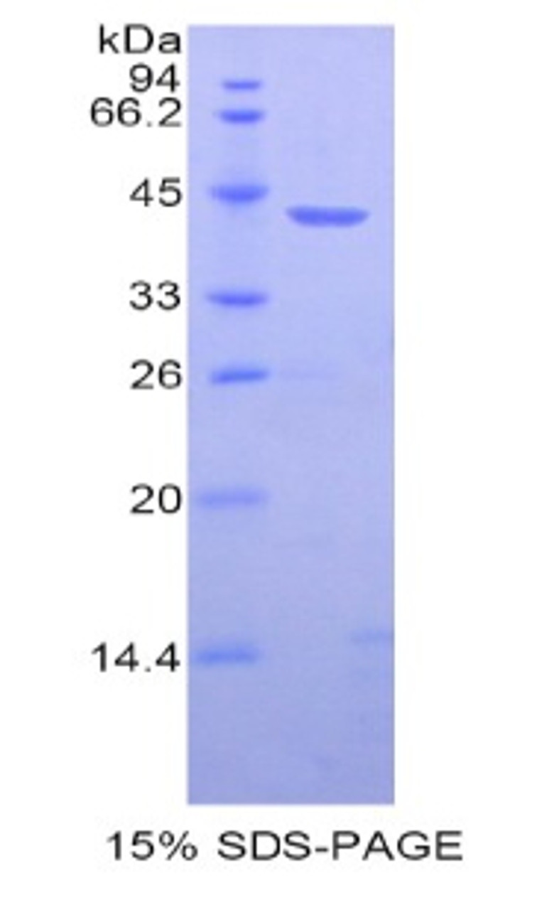 Human Recombinant Histone Cluster 1, H2ab (HIST1H2AB)