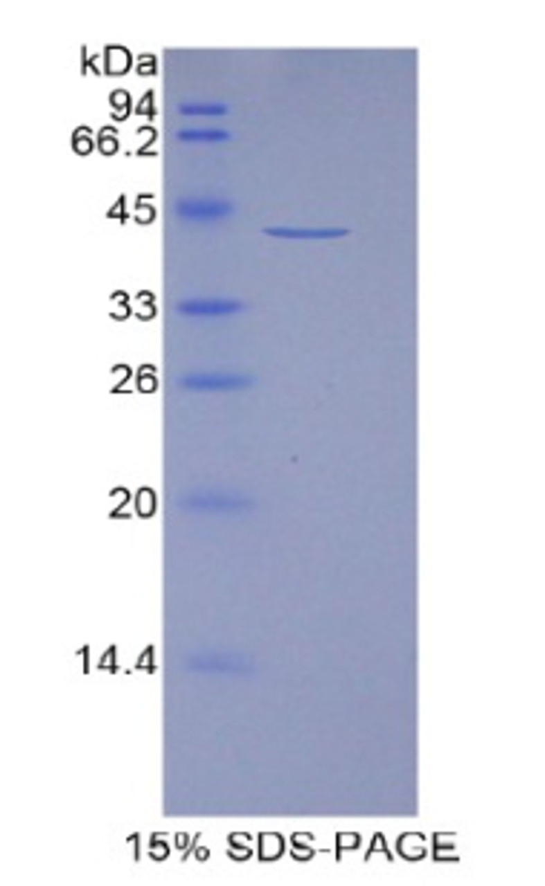 Human Recombinant Histone Cluster 1, H2aj (HIST1H2AJ)