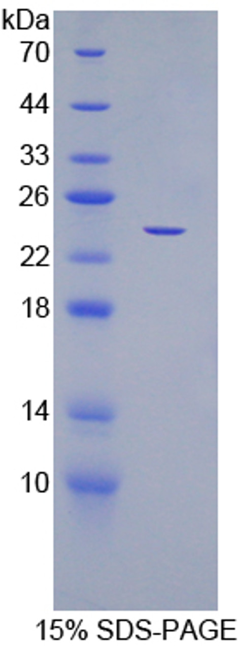 Human Recombinant Cell Division Cycle Protein 25B (CDC25B)