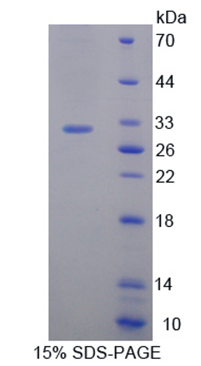 Mouse Recombinant BMX Non Receptor Tyrosine Kinase (BMX)