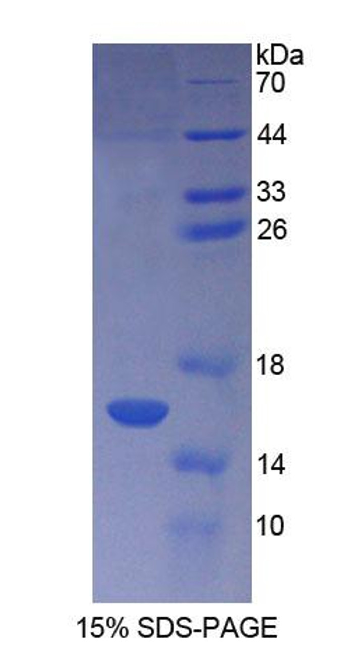 Human Recombinant Coupling Factor 6 (CF6)