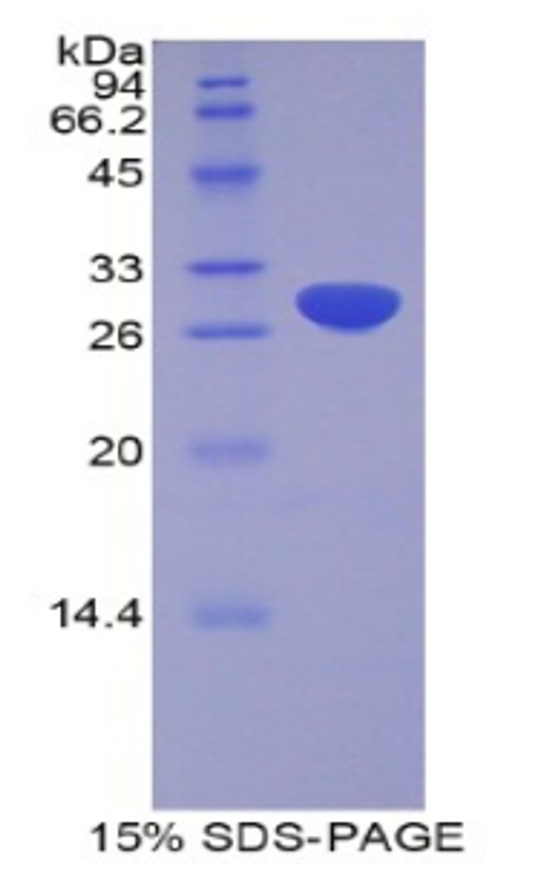 Human Recombinant A Disintegrin And Metalloprotease 20 (ADAM20)