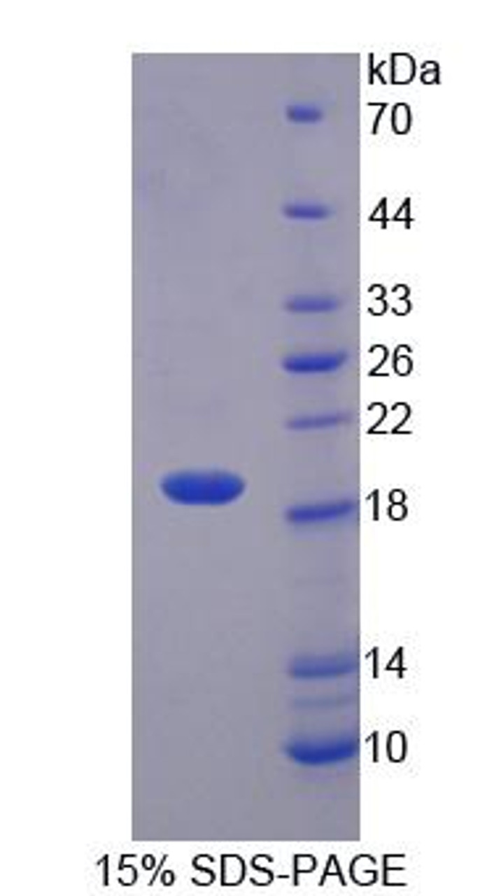 Human Recombinant Interleukin 1 Theta (IL1q)