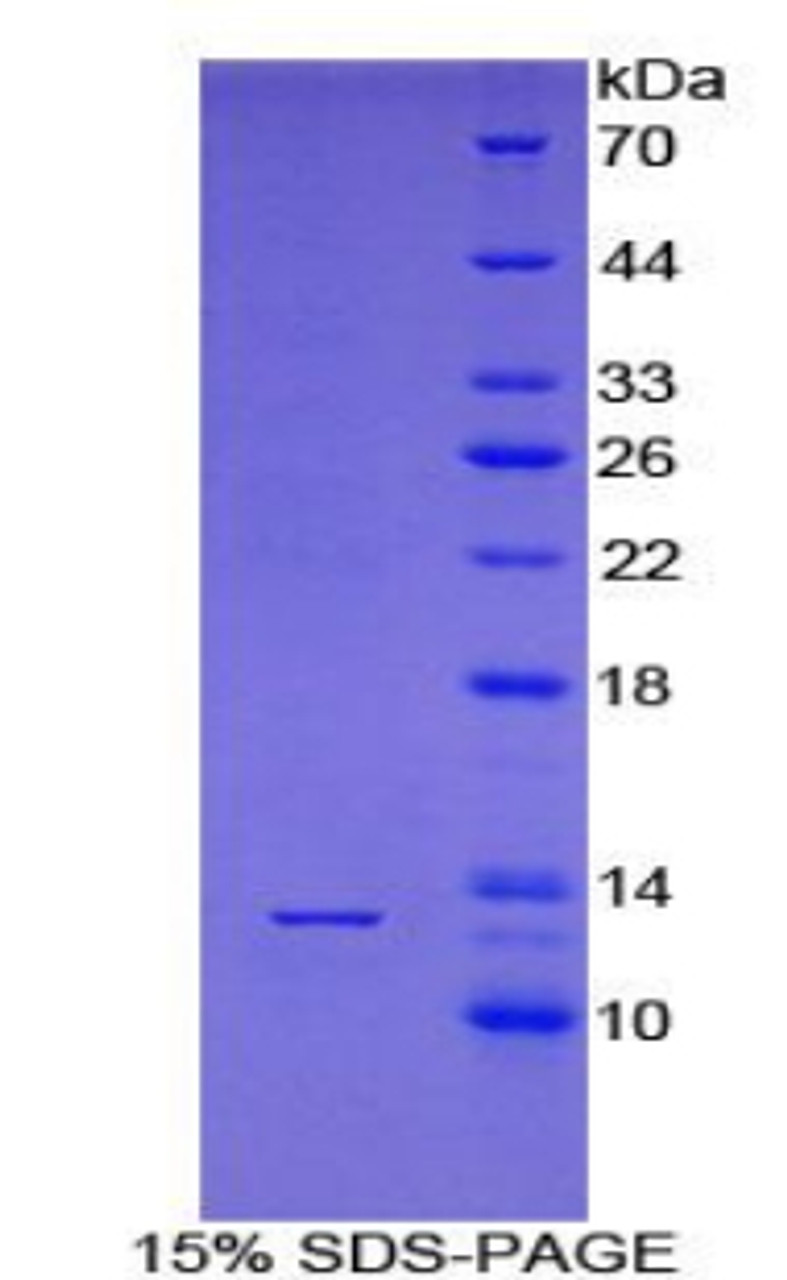 Human Recombinant Poly A Binding Protein Cytoplasmic 1 Like Protein (PABPC1L)