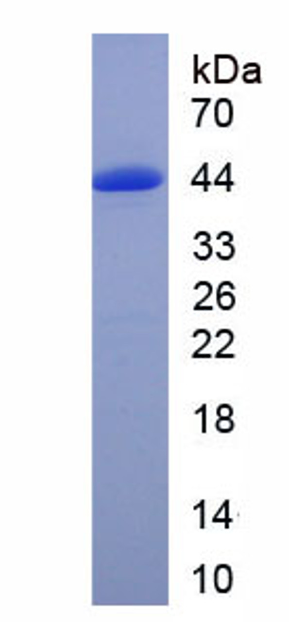 Human Recombinant Defensin Beta 126 (DEFb126)