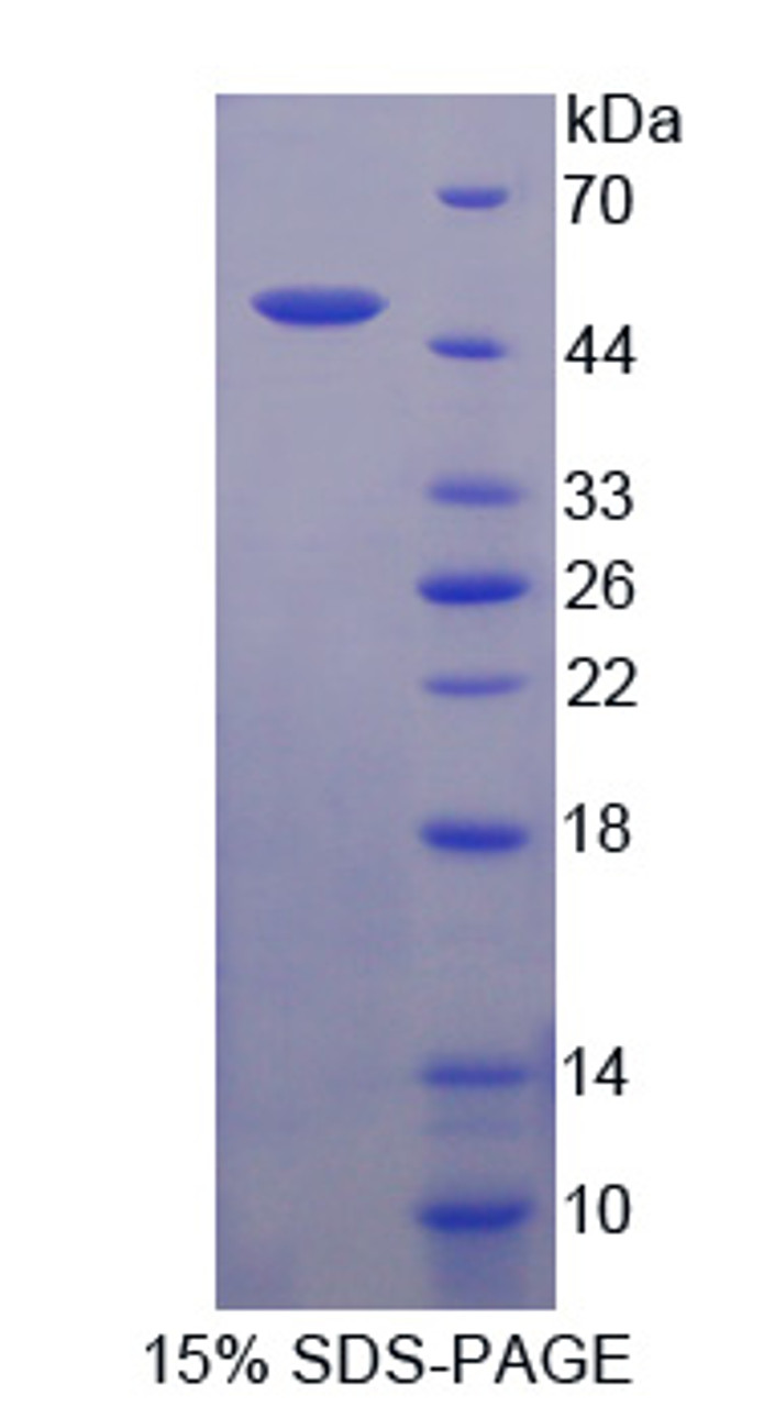 Cattle Recombinant Peptidase Inhibitor 16 (PI16)