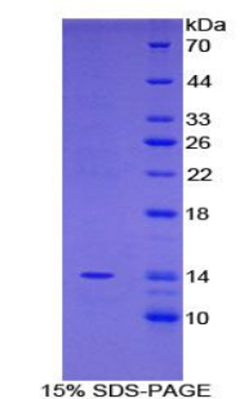 Mouse Recombinant Family With Sequence Similarity 19, Member A2 (FAM19A2)
