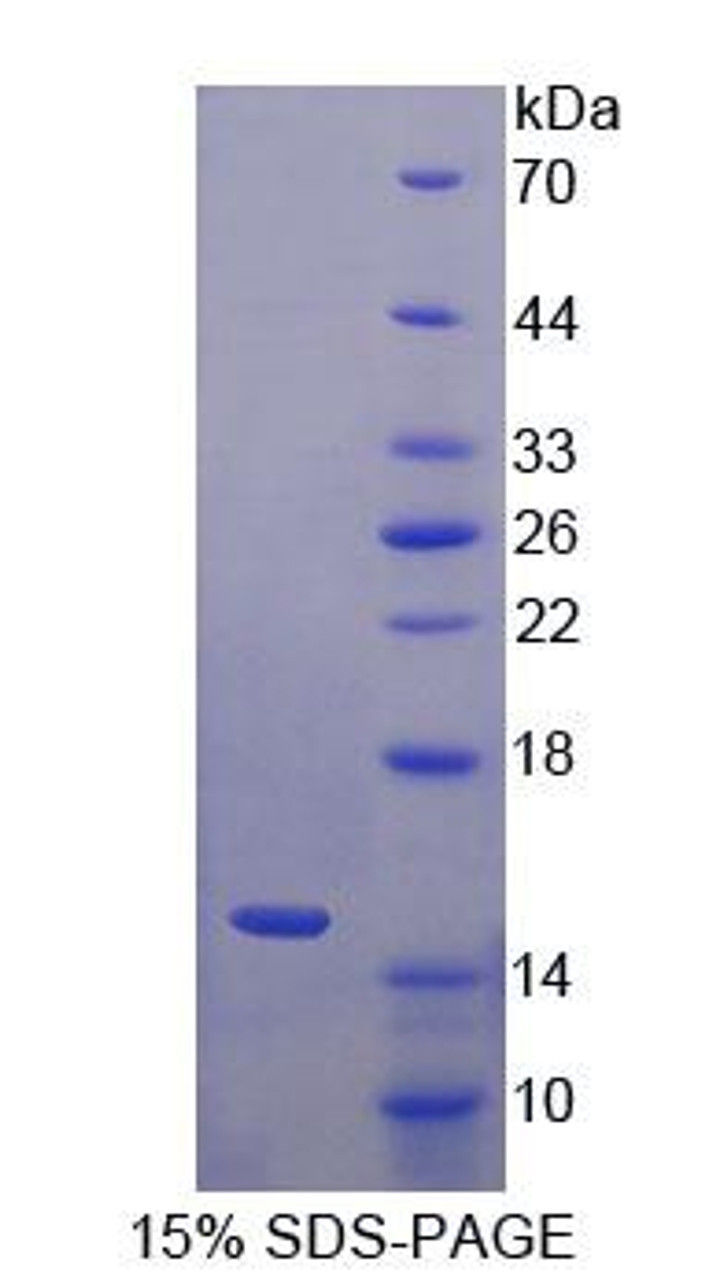 Human Recombinant S100 Calcium Binding Protein A15 (S100A15)