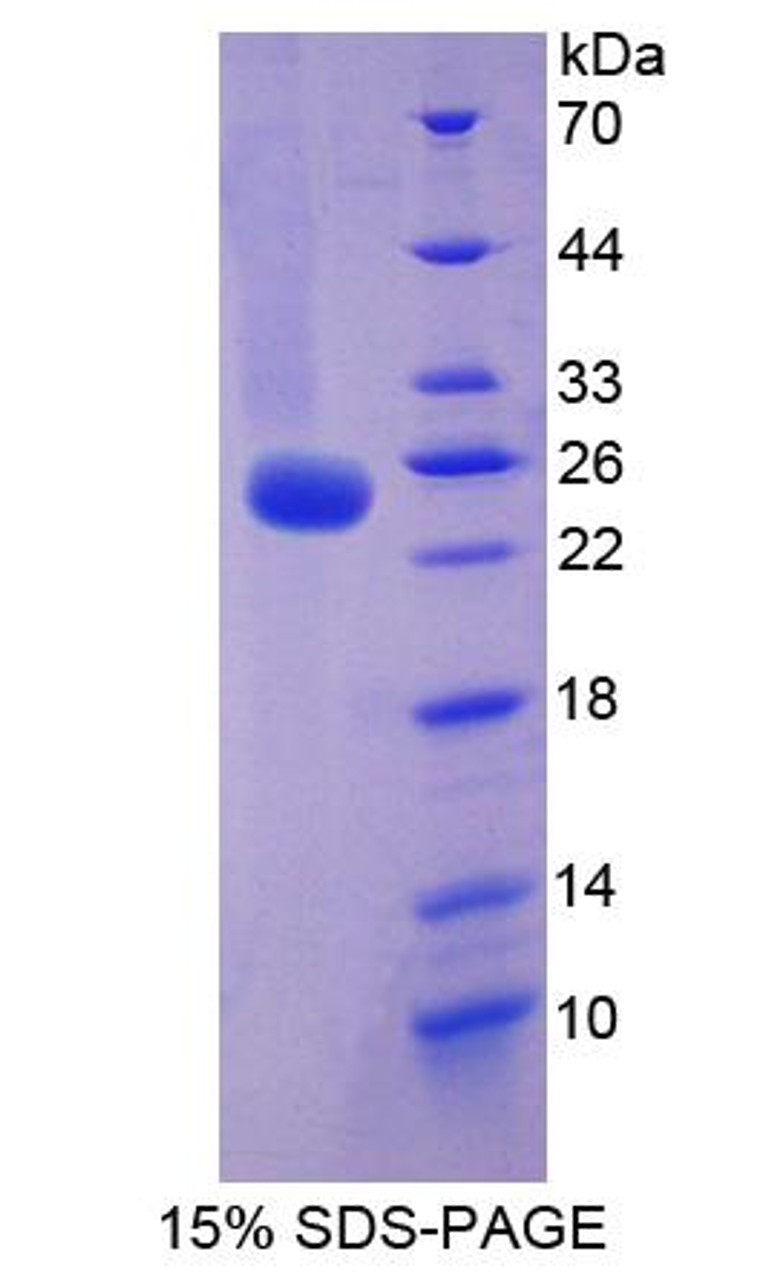 Human Recombinant Family With Sequence Similarity 5, Member C (FAM5C)