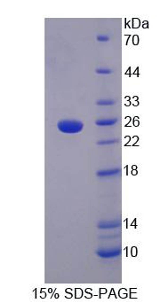 Human Recombinant LETM1 Domain Containing Protein 1 (LETMD1)