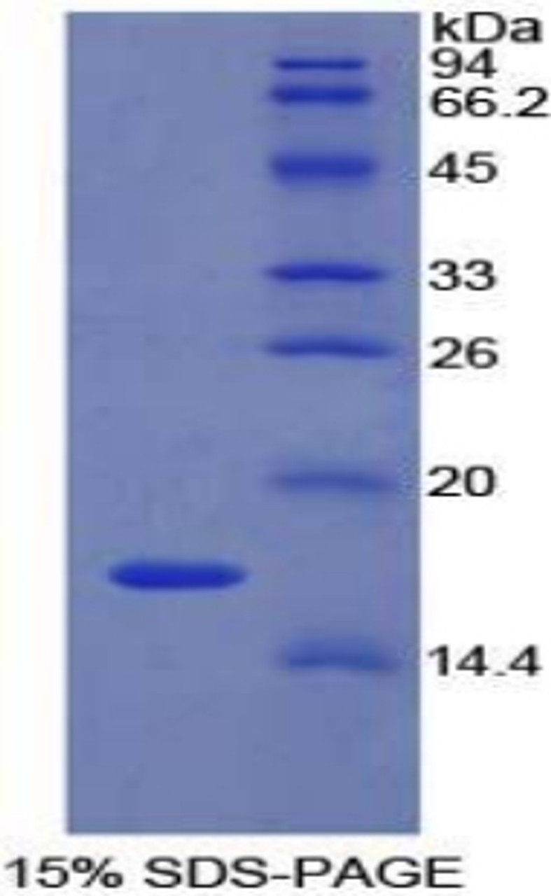 Rat Recombinant Ly1 Antibody Reactive Homolog (LYAR)