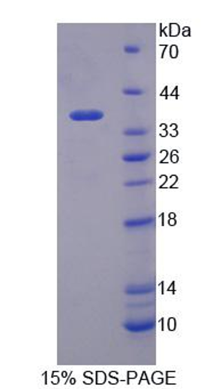 Human Recombinant MOCO Sulphurase C-Terminal Domain Containing Protein 1 (MOSC1)